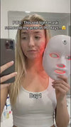 Radiant Glow LED Face Mask:7- Color Light Theraphy